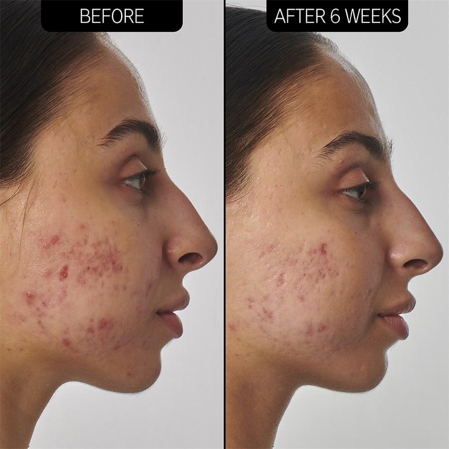 The INKEY List Sieri SuperSolutions 1% Retinol Serum Sconto