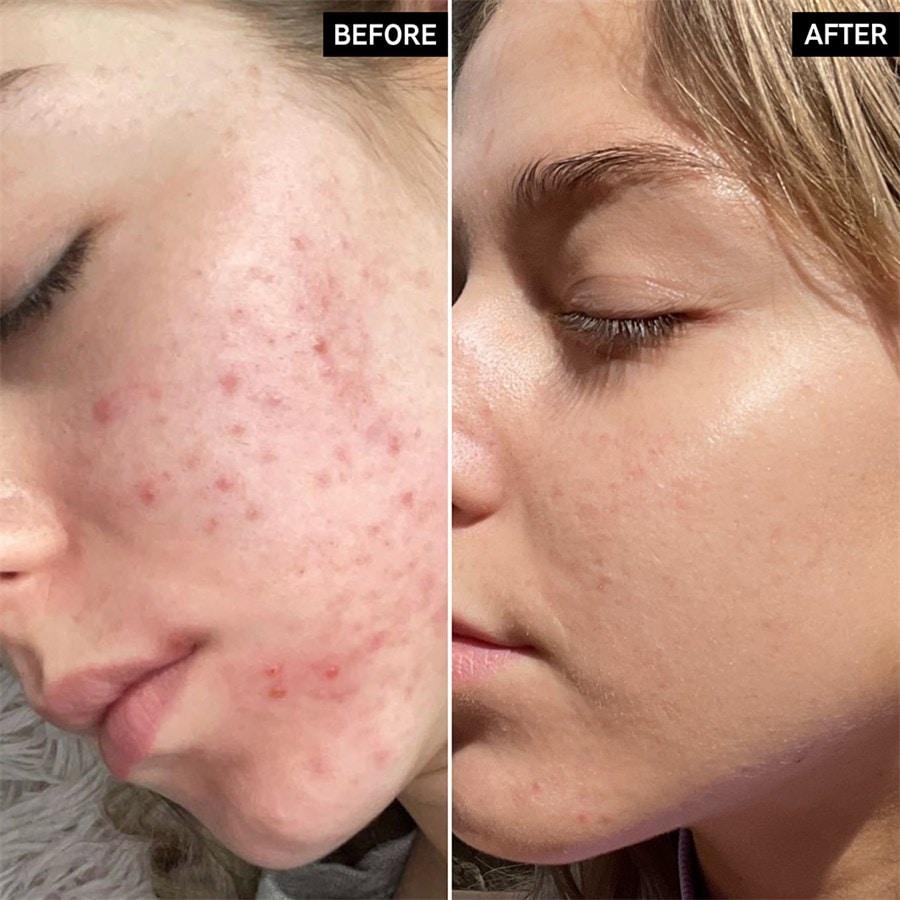 The INKEY List Sieri Niacinamide Serum Lightning offer